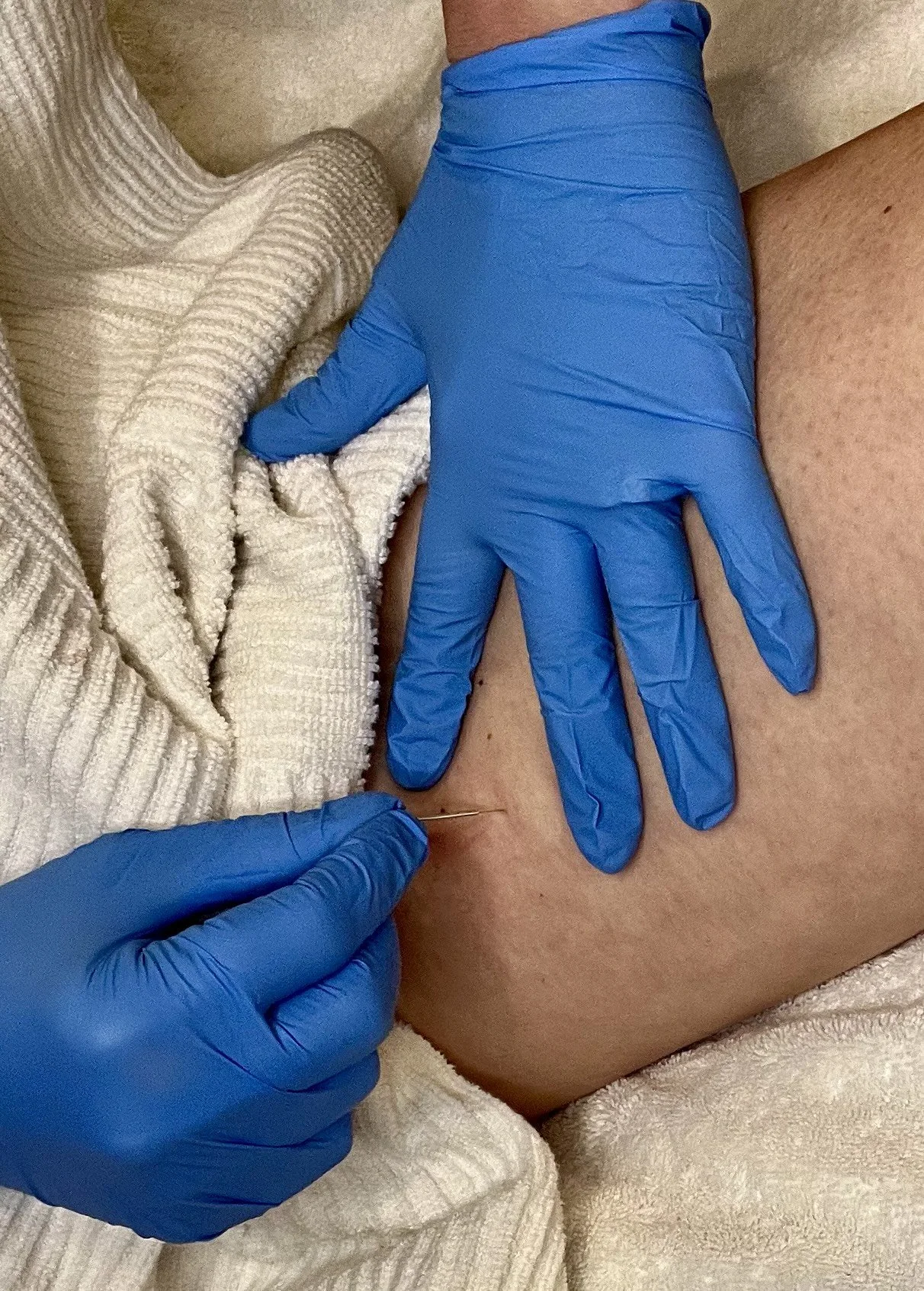 Cupping self-release