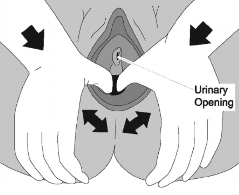 Perineal stretching vaginal birth prep