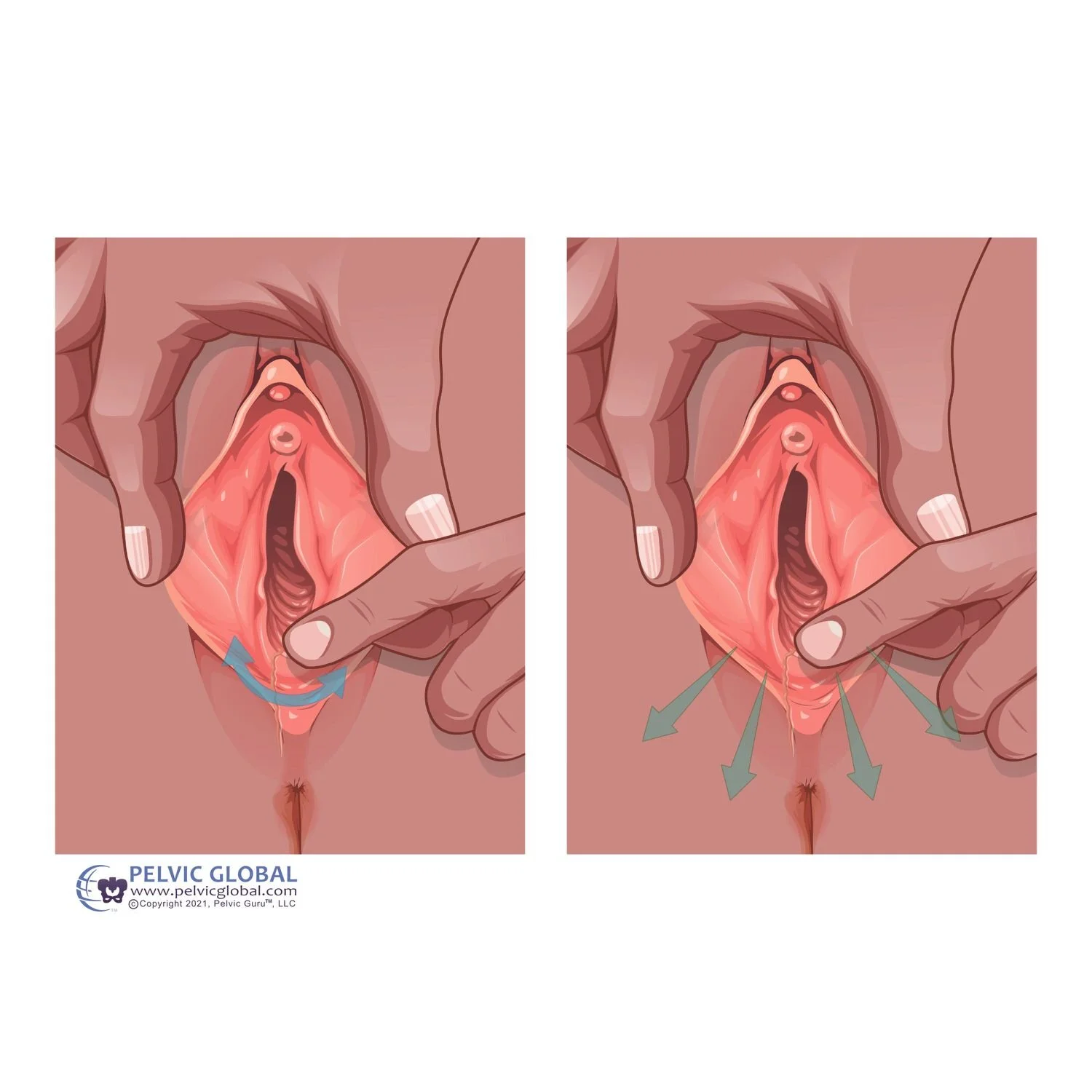 perineal massage pelvic floor physical therapy