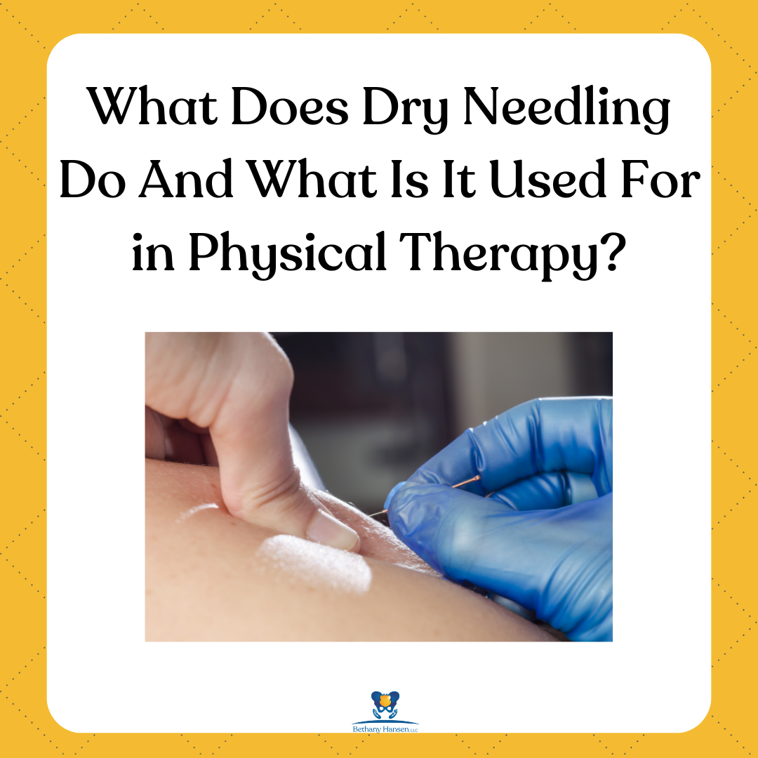 What Does Dry Needling Do and What Is It Used For In Physical Therapy?